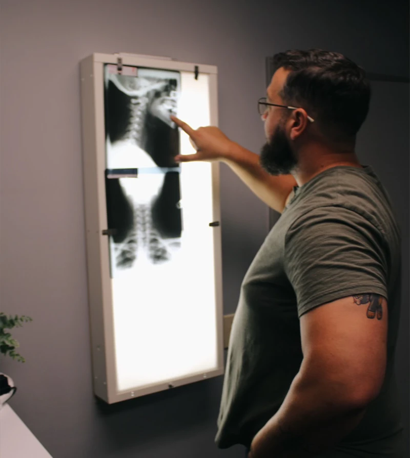 Dr. Jake Harris standing beside an illuminated X‑ray display